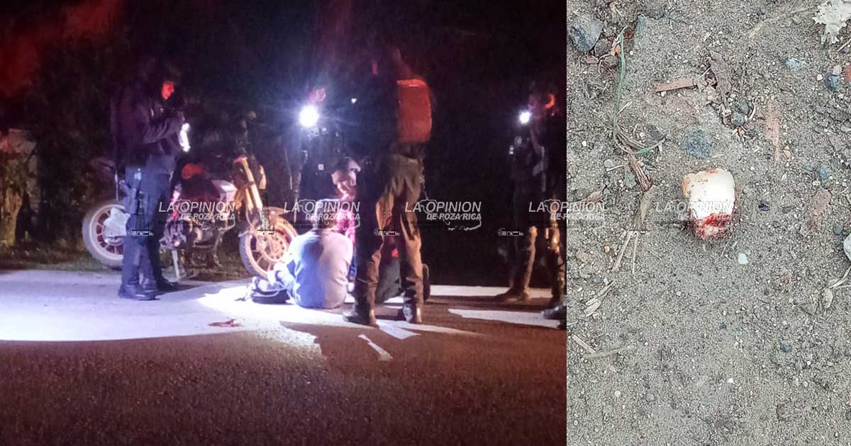Motociclista pierde parte de su dentadura al derrapar en su caballo de acero