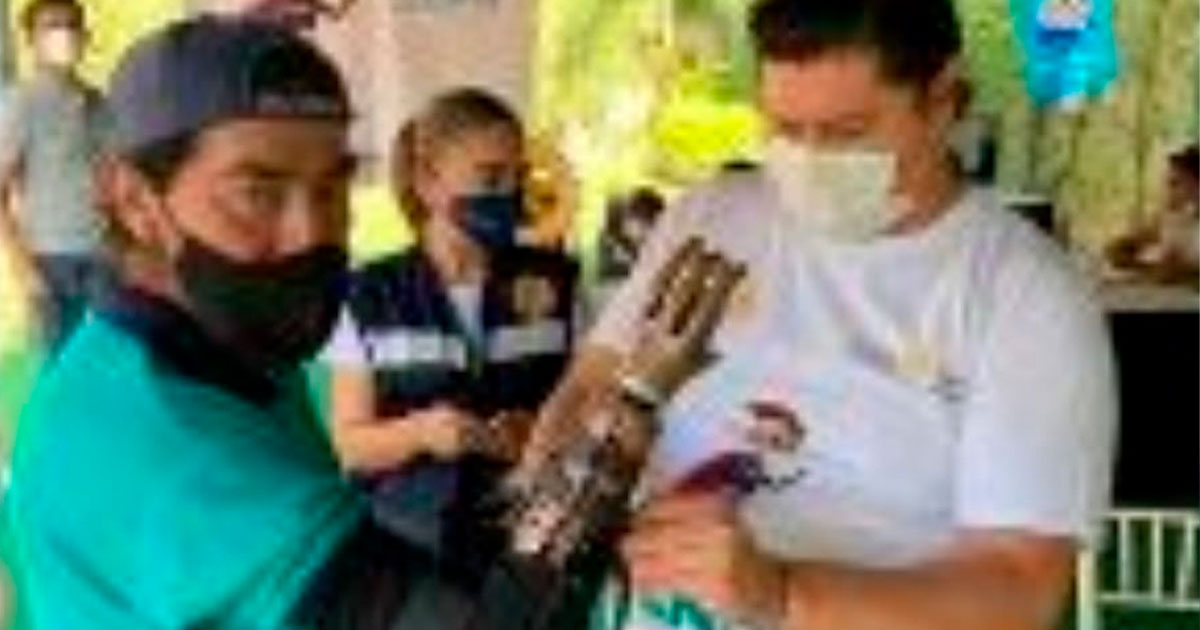 "Te damos una mano" entregará prótesis gratuitas