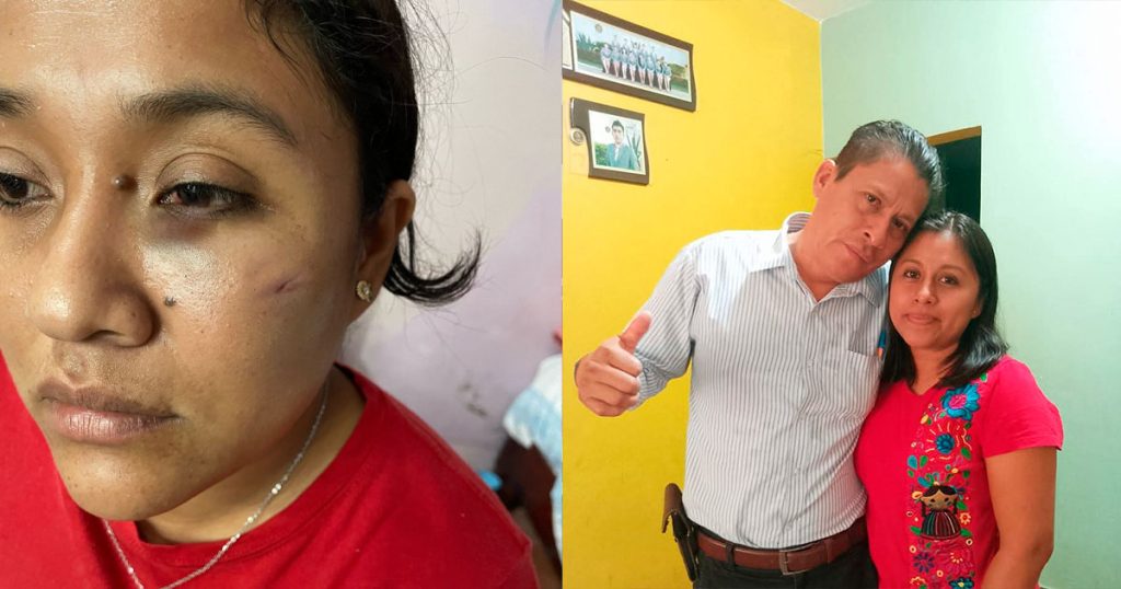 Denuncian en Fiscalía por lesiones a hija del alcalde de Tatahuicapan