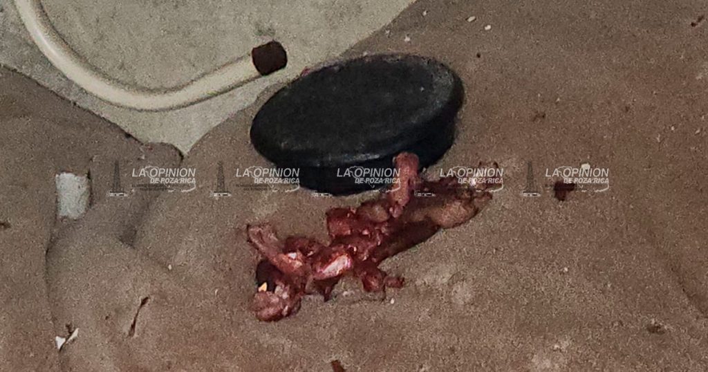 Albañil perdió la mano al abrir un obsequio