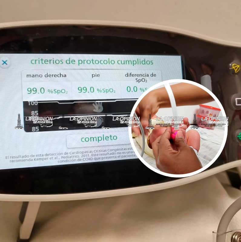 Tamiz neonatal detecta enfermedades en bebés de 3 a 5 días Tamiz neonatal detecta enfermedades en bebés de 3 a 5 días