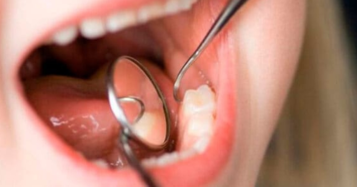 Falta de higiene dental provoca varias enfermedades a niños y adultos