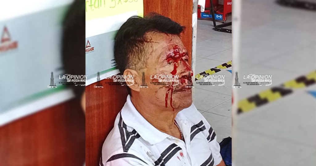 Golpeo con banqueta frente a mercado Ebrio cae y se lesiona rostro