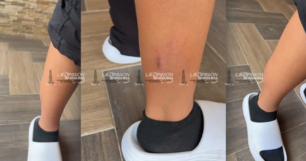 Derriban motociclista y se dan a la fuga Derriban motociclista y se dan a la fuga