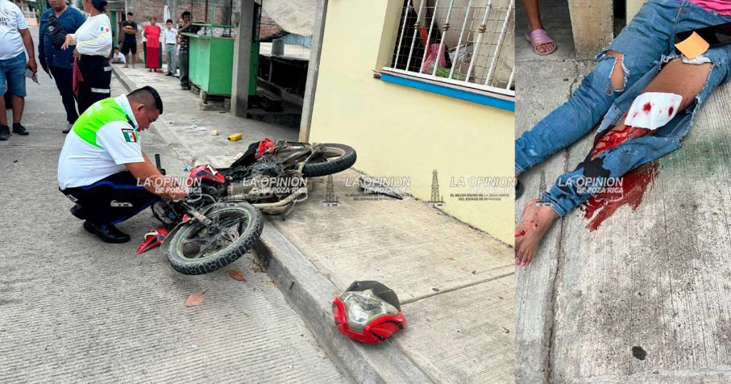 Motociclista sufrió fractura tras ser derribado Motociclista sufrió fractura tras ser derribado