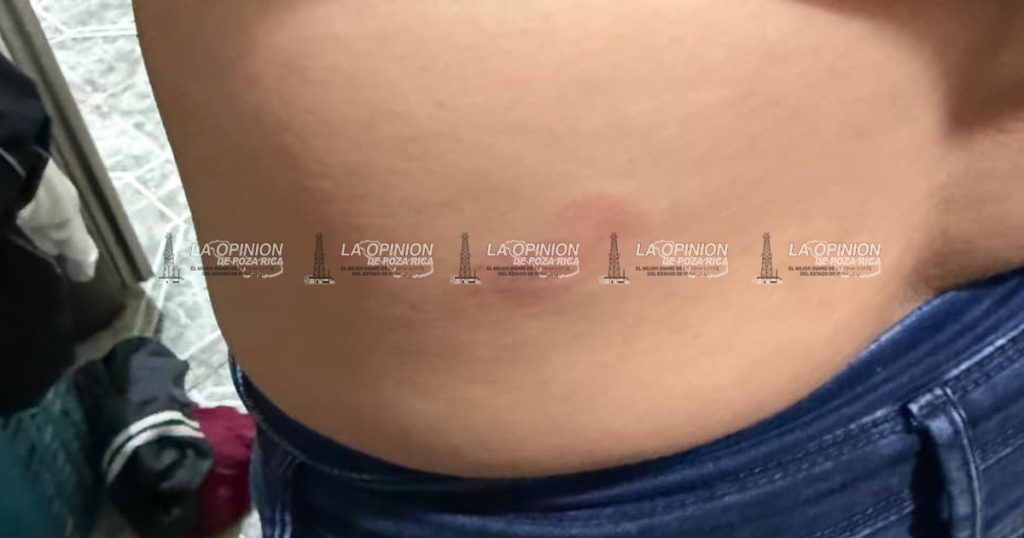 Policía de Soledad de Doblado golpea brutalmente a pareja
