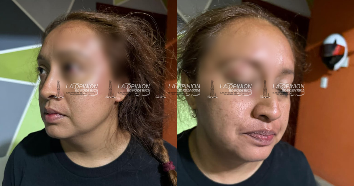Policía de Soledad de Doblado golpea brutalmente a pareja