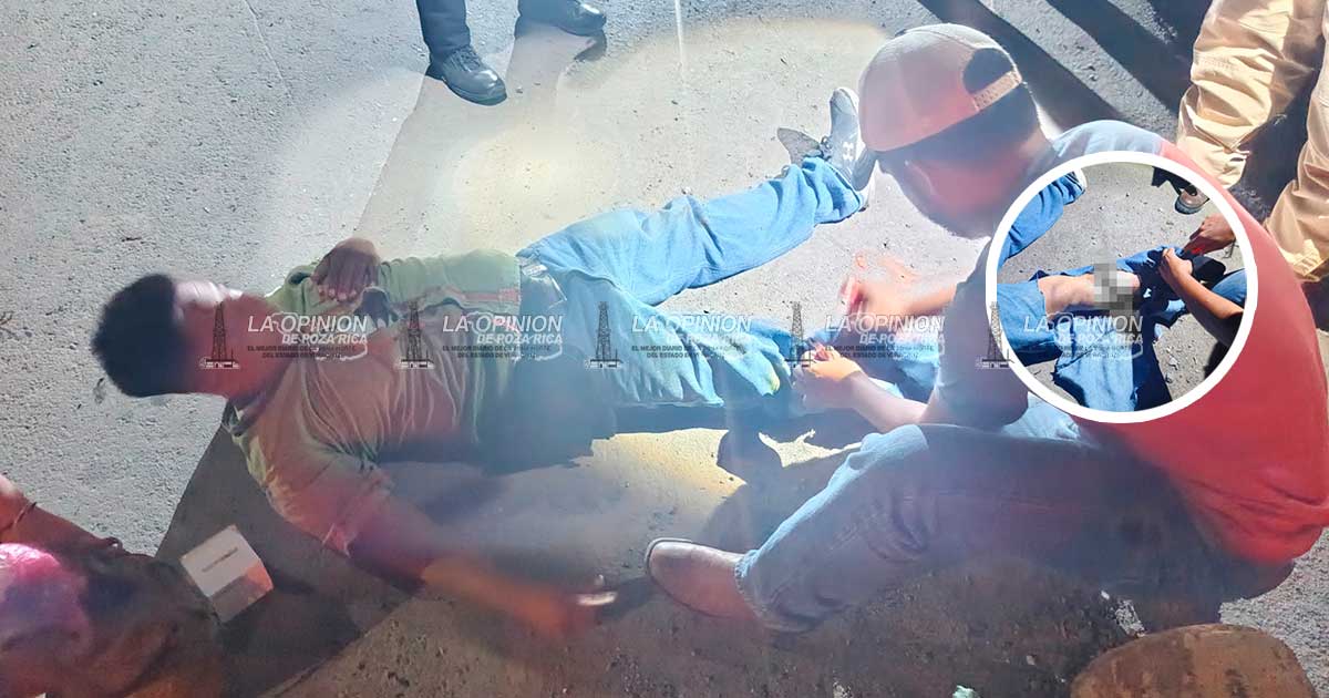 Se fractura una pierna al derrapar en su motocicleta