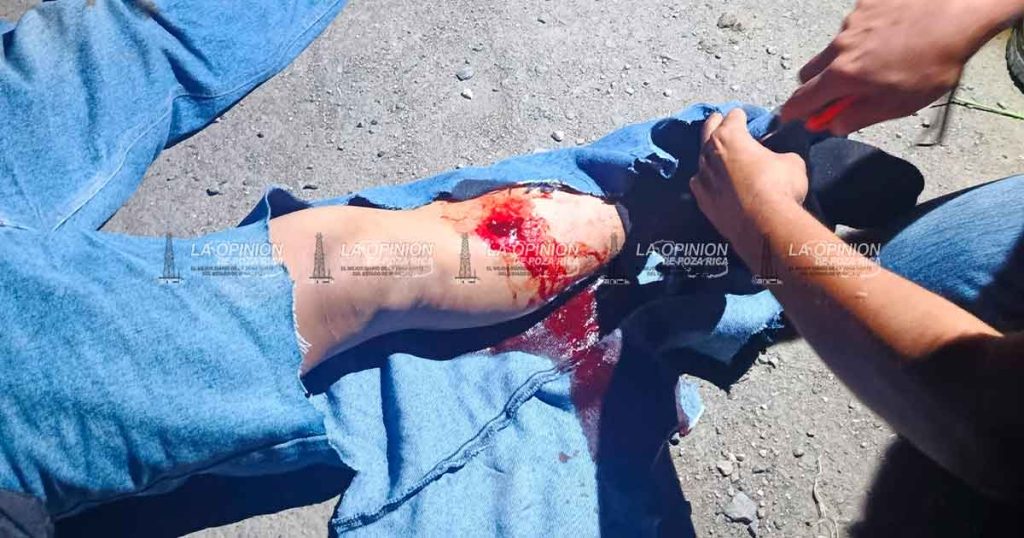 Se fractura una pierna al derrapar en su motocicleta