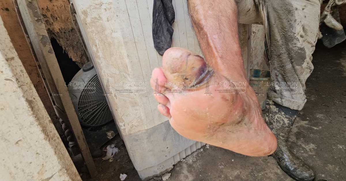 Habitantes de las Granjas presentan infecciones tras inundación Habitantes de las Granjas presentan infecciones tras inundación