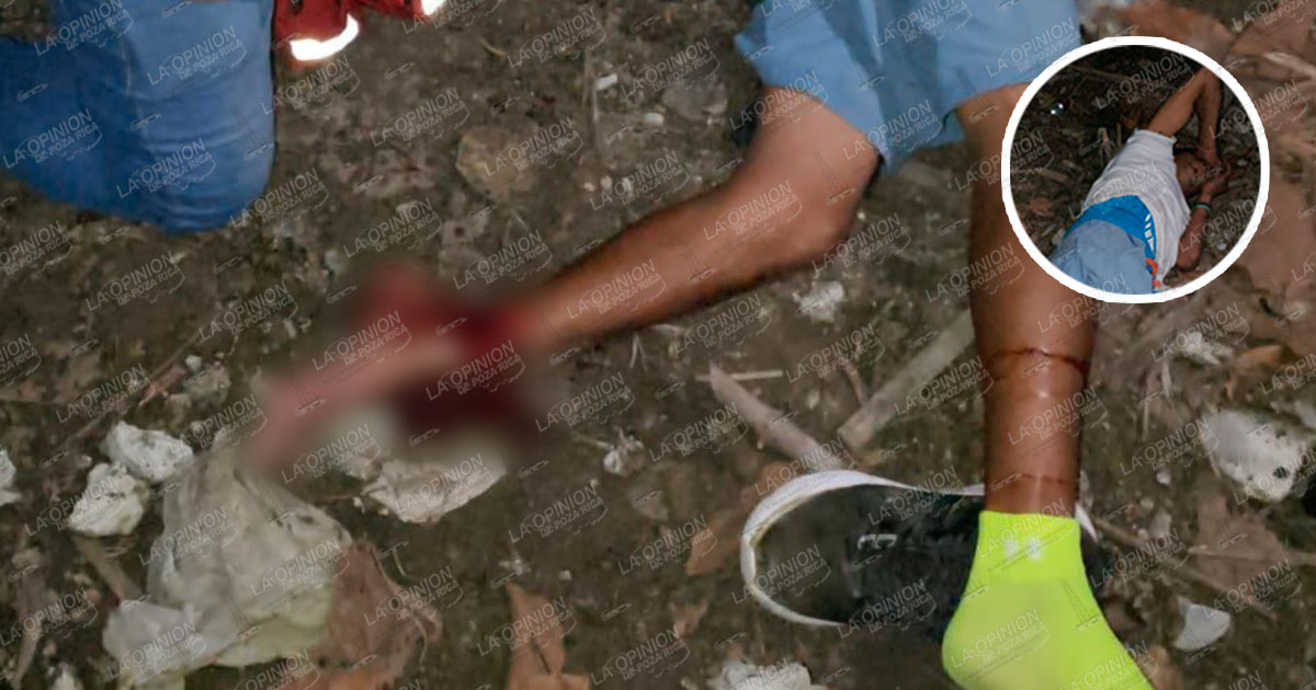 Fracturado tras caer de una segunda planta Fracturado tras caer de una segunda planta