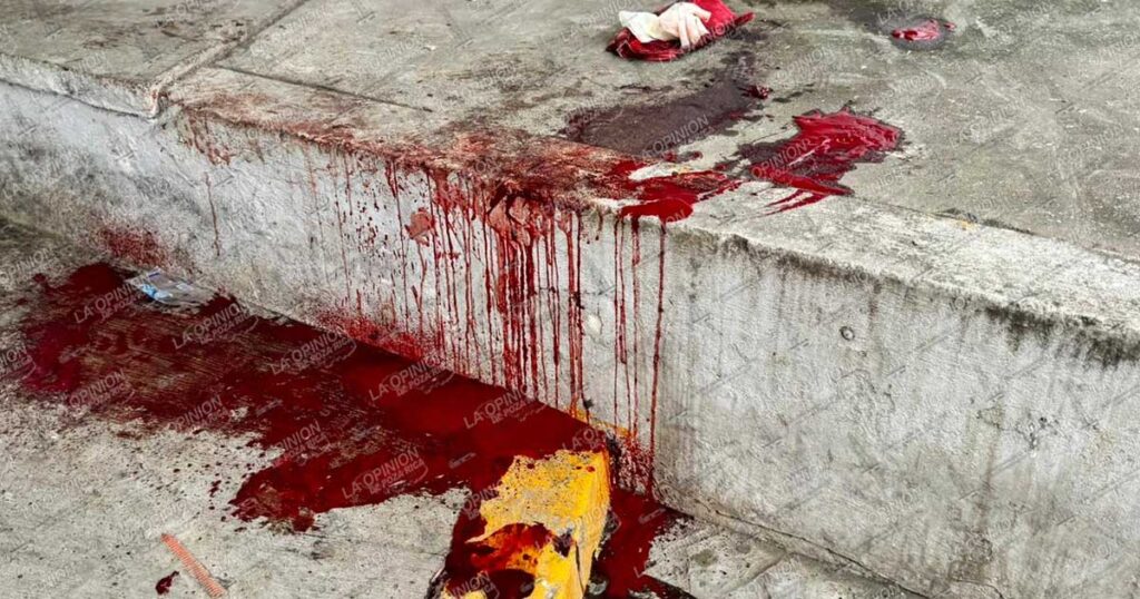 Se debate entre la vida y la muerte Se debate entre la vida y la muerte