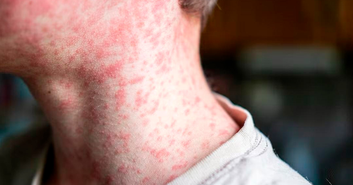 EEUU atacado por el virus EEUU atacado por el virus