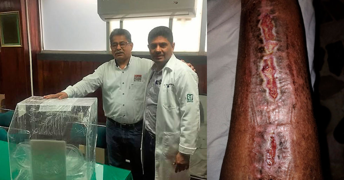 NEGLIGENCIA EN IMSS DE TUXPAN NEGLIGENCIA EN IMSS DE TUXPAN
