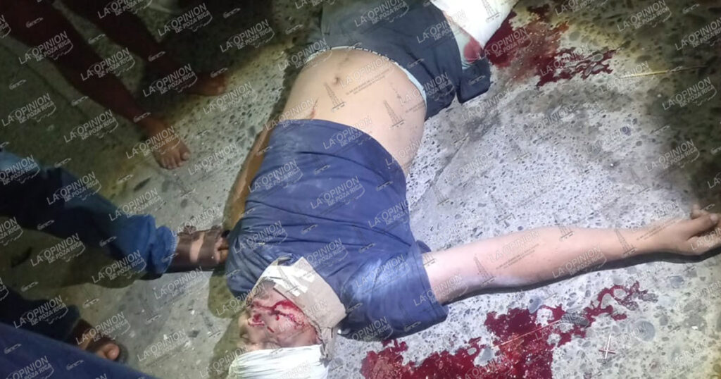 Motociclista al borde de la muerte Motociclista al borde de la muerte