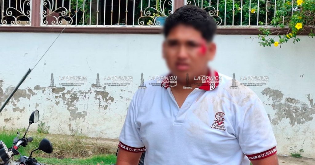 Accidente de motocicleta; dos estudiantes lesionados Accidente de motocicleta; dos estudiantes lesionados