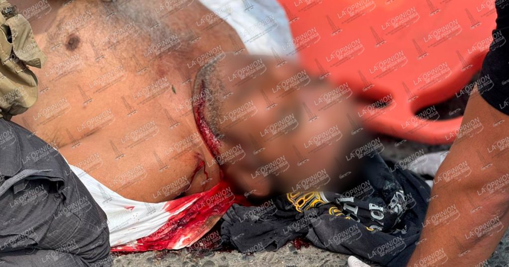 Muere mototortillero tras un Moto vs. Auto Muere mototortillero tras un Moto vs. Auto