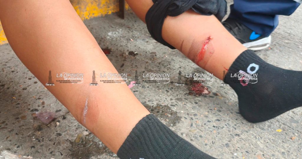 CAMIÓN DE PEMEX LA ATROPELLA