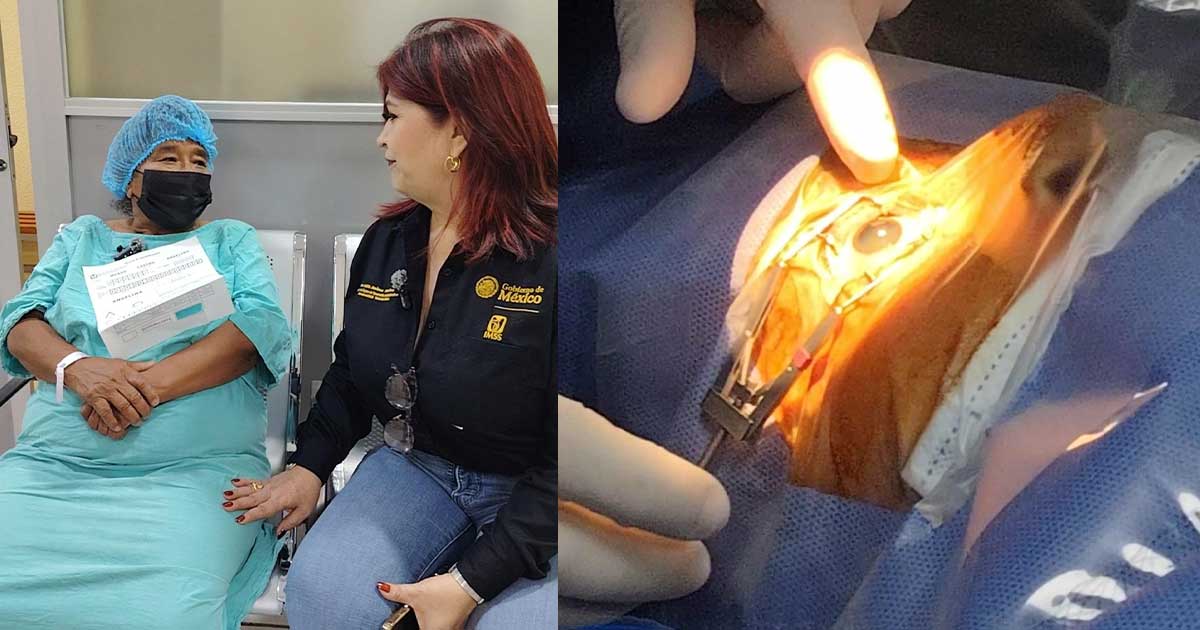 Beneficia IMSS Veracruz Norte a 470 derechohabintes por medio de Jornadas Quirúrgicas