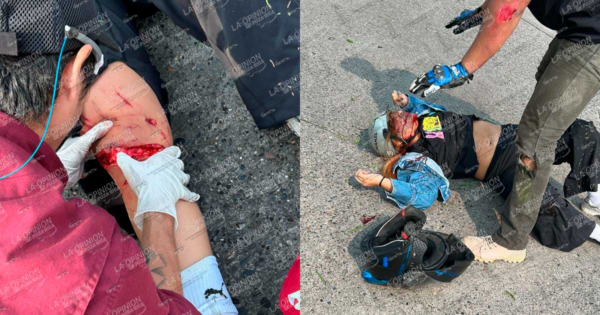 Pareja motorizada termina herida en choque