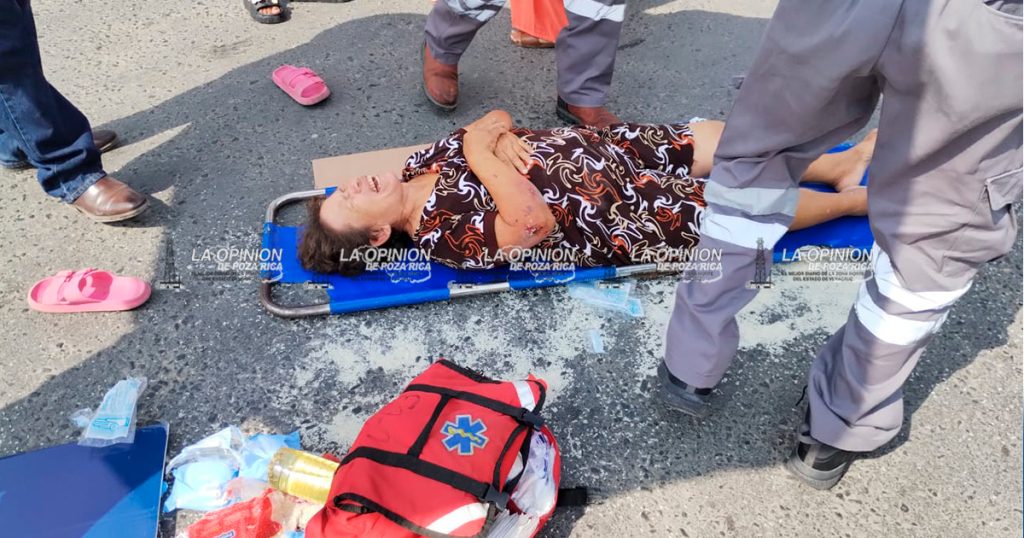 Mujer de la tercera edad resulta gravemente lesionada tras ser atropellada en la carretera Cazones–Poza Rica