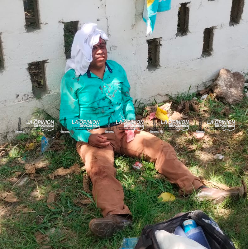 Ataque epiléptico provoca aparatoso accidente de motociclista en la carretera Cazones–Poza Rica