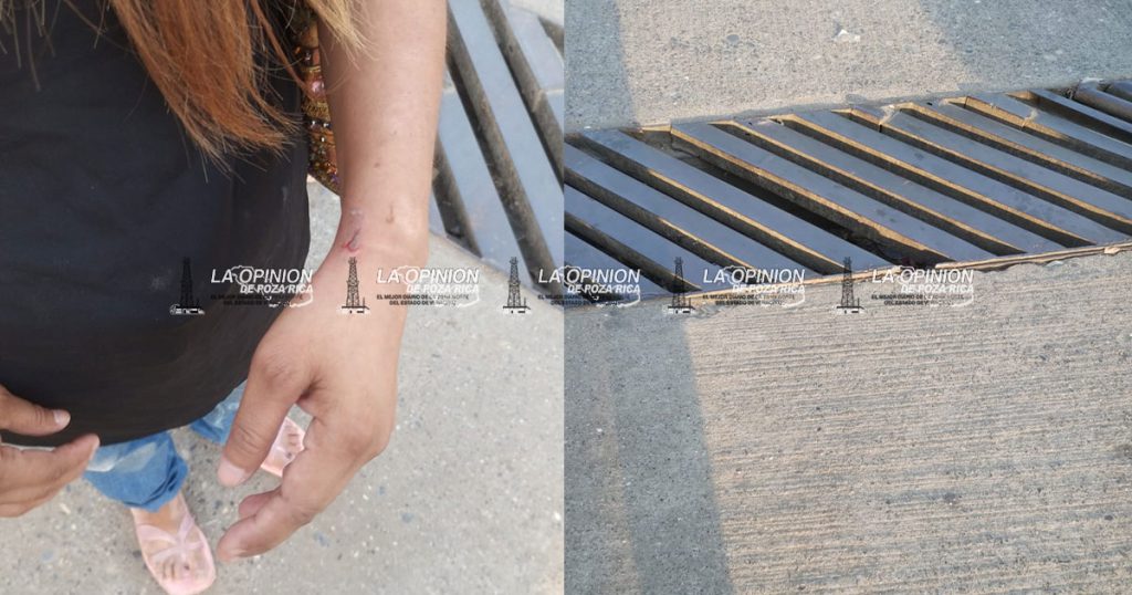 Mujer resulta lesionada al caer en alcantarilla con rejilla dañada en pleno bulevar Ruiz Cortines Mujer resulta lesionada al caer en alcantarilla con rejilla dañada en pleno bulevar Ruiz Cortines
