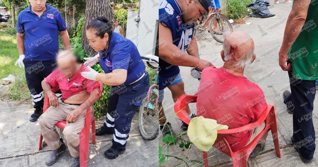 Adulto mayor resulta herido tras ser atropellado por motociclista en Tihuatlán Adulto mayor resulta herido tras ser atropellado por motociclista en Tihuatlán