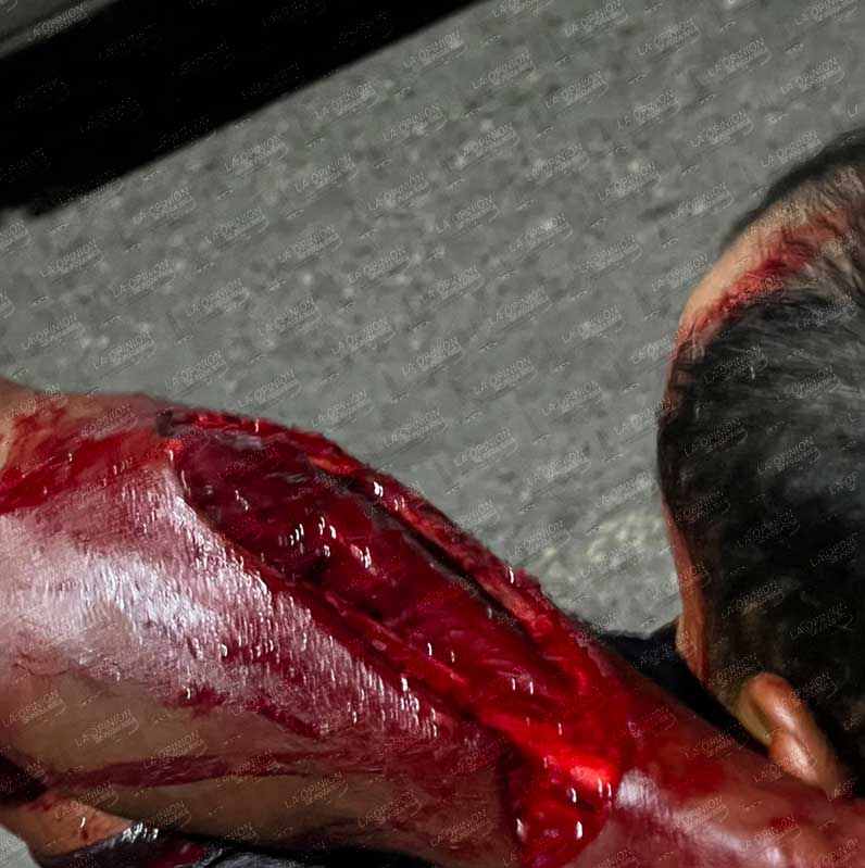 Motociclista casi se queda sin brazo