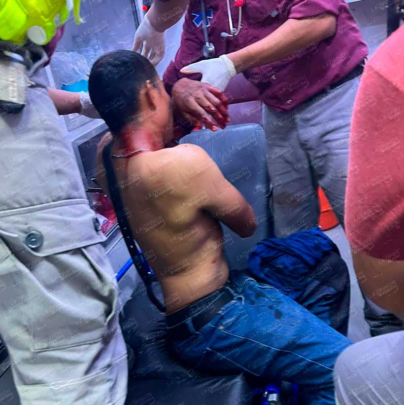Motociclista casi se queda sin brazo