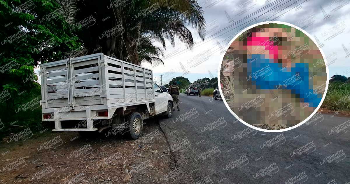 Alumna queda grave tras ser atropellada Alumna queda grave tras ser atropellada