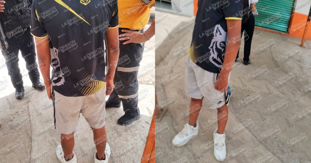 Atropellan a adolescente en el bulevar Lázaro Cárdenas Atropellan a adolescente en el bulevar Lázaro Cárdenas