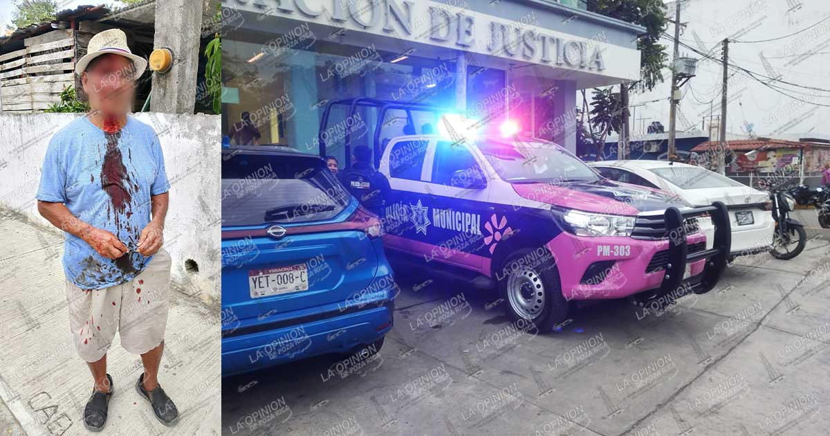 Ataca a machetazos a su hermano y escapa; operativo en Poza Rica Ataca a machetazos a su hermano y escapa; operativo en Poza Rica
